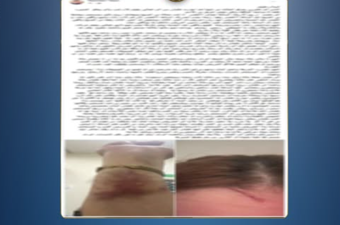 كشف ملابسات مشاجرة داخل مستشفى ببورسعيد بين سيدات وممرضتين